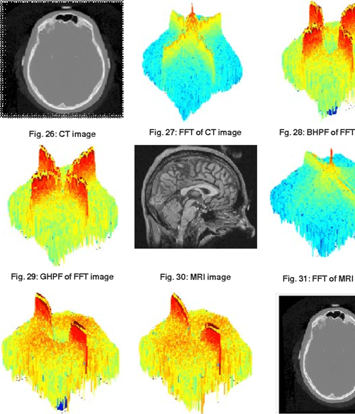 [PDF] Image Sharpening By Gaussian And Butterworth High Pass Filter