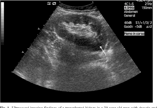 Figure 1 from Diagnosis of acute pyelonephritis by contrast-enhanced ...