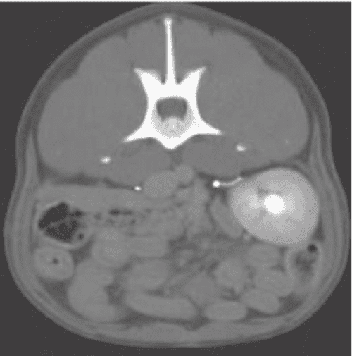 [PDF] Cystoscopicguided laser ablation of an intramural ectopic ureter