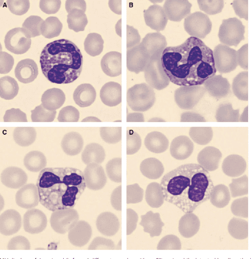 Canine differential leukocyte counting with the CellaVision DM96Vision