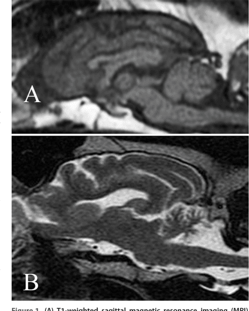 Late onset Cerebellar Abiotrophy In A Labrador Retriever Semantic 