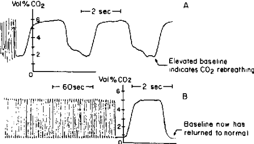 normal end tidal co2 kpa