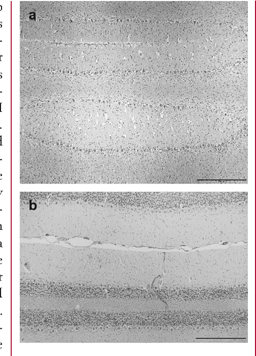 Figure 1 From Cerebellar Cortical Abiotrophy In Lagotto Romagnolo Dogs 