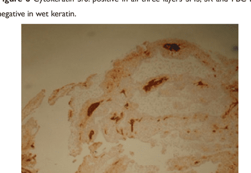 Figure 1 From Differential Expression Of Immunohistochemistry Markers 