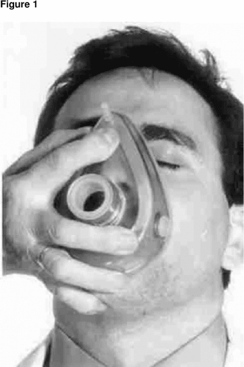 Figure 1 from An Unusual Pattern Of Osteoarthritis Of The Fingers In A