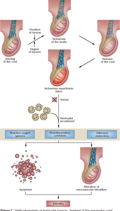 Figure 1 from Mechanisms of testicular torsion and potential protective