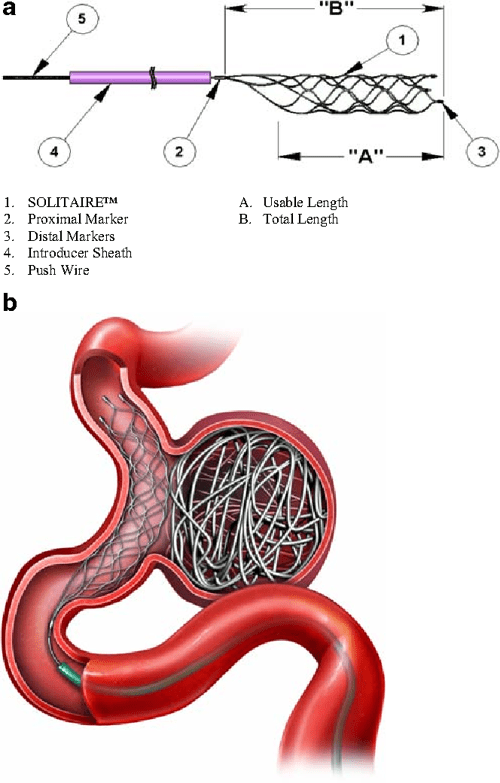 Coil embolization of anterior circulation aneurysms supported by the Solitaire™ AB Neurovascular