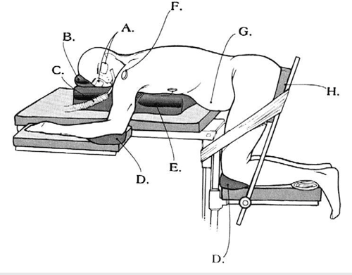 Figure 10 From ADVANCES IN ANESTHESIA Positioning Injuries In 