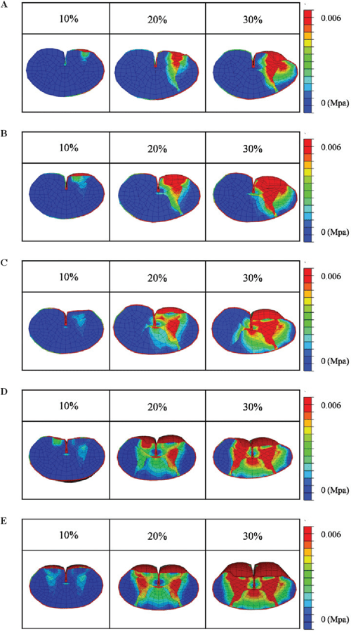 Figure 2 From Biomechanical Analysis Of The Spinal Cord In Brown 