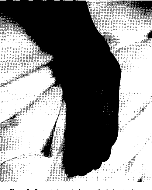 Abdominal Pain with a Centrifugal Rash | Semantic Scholar