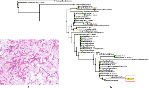 Herbaspirillum Species A Potential Pathogenic Bacteria Isolated from