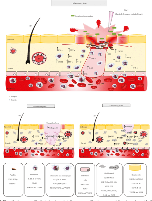 Figure 1 from Wound Healing and Omega6 Fatty Acids From Inflammation