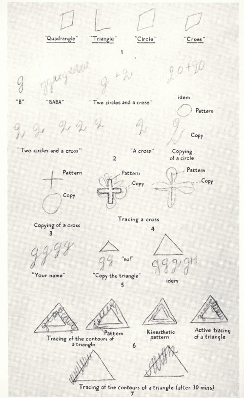 Figure 2 from TWO KINDS OF MOTOR PERSEVERATION IN MASSIVE INJURY OF THE