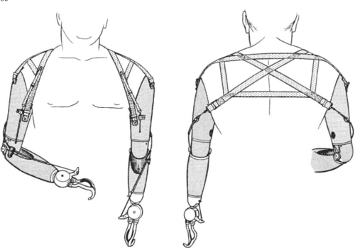 [PDF] Harness patterns for upper-extremity prostheses. | Semantic Scholar