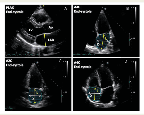 Dissertation meaning picture