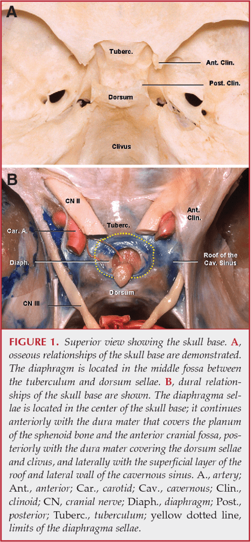 Figure 3 from MICROSURGICAL ANATOMY OF THE DIAPHRAGMA SELLAE AND ITS