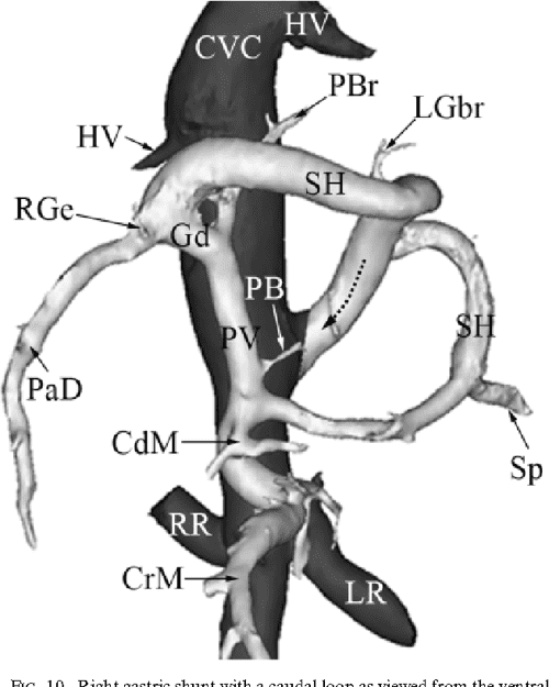 Figure 8 from Anatomy of extrahepatic portosystemic shunts in dogs as