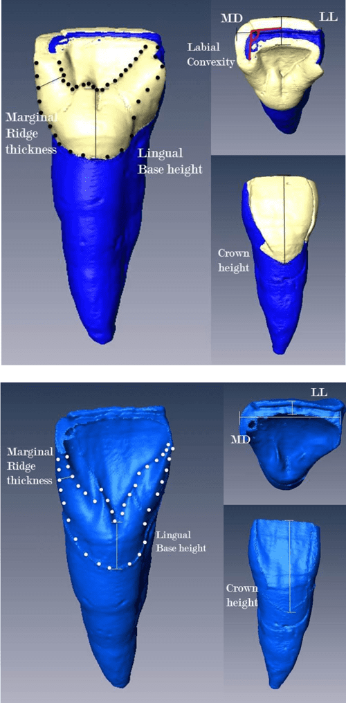 Shovelshaped incisors and the morphology of the enameldentin junction