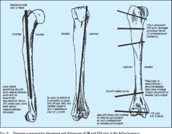 [PDF] The feline humerus. An anatomical study with relevance to