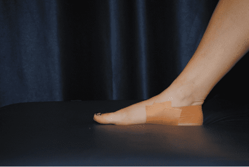 Figure 27 from A Comparison of Two Tape Techniques on Navicular Drop ...
