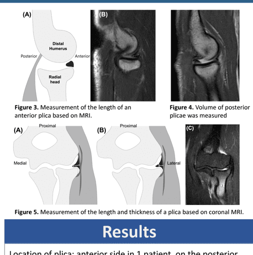 Prominent synovial plicae in radiocapitellar joints as a potential