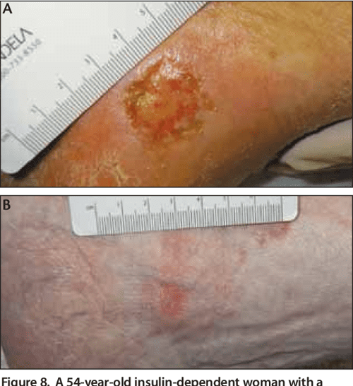 celine water for wound care