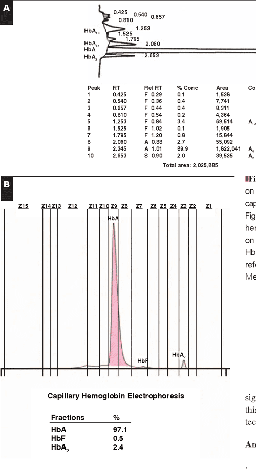 [PDF] Comparison of Sebia Capillarys capillary electrophoresis with the