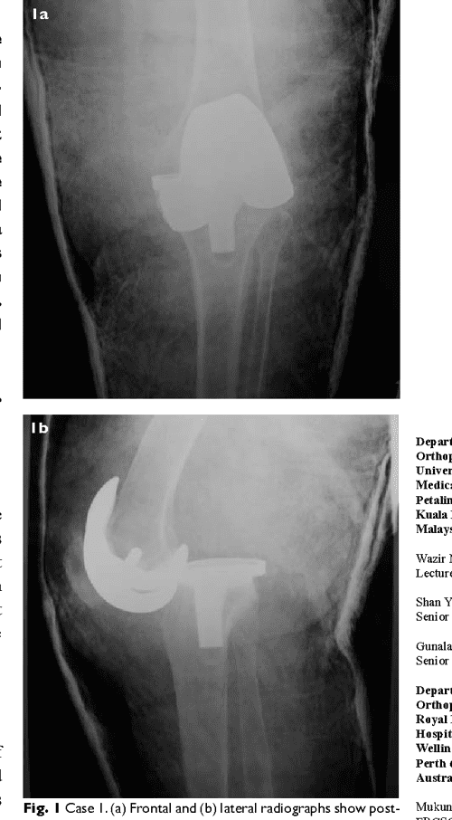 Weightlifting terms picture