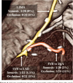 Cabg thesis topics image
