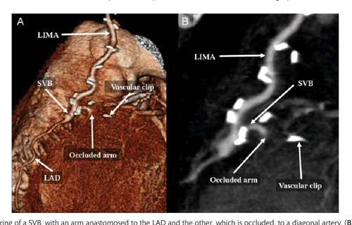 Cabg thesis topics 08 image
