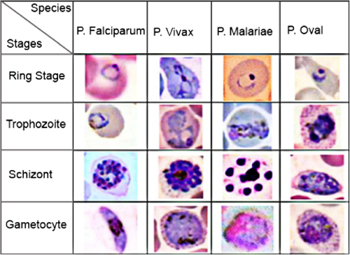  PDF A Review On Automated Diagnosis Of Malaria Parasite In 
