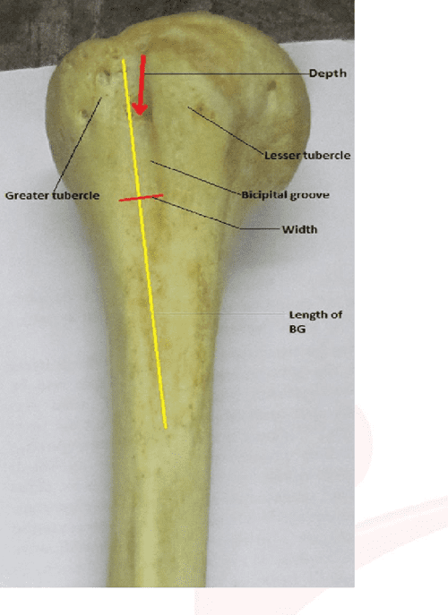 Figure 1 from MORPHOMETRIC ANALYSIS OF BICIPITAL GROOVE OF HUMERUS WITH