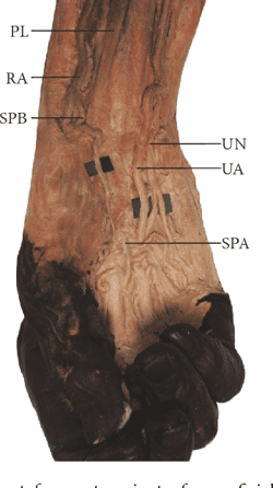Radial artery thesis 08 image