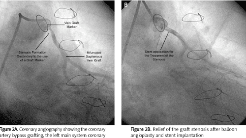 Cabg thesis topics 04 picture