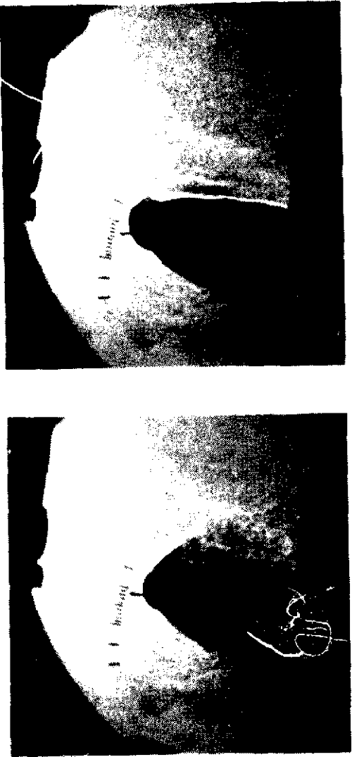 Figure 21 From An Experimental Study Of Dynamic Stall On Advanced