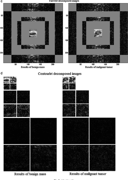 Figure 1 from Shearletbased texture feature extraction for