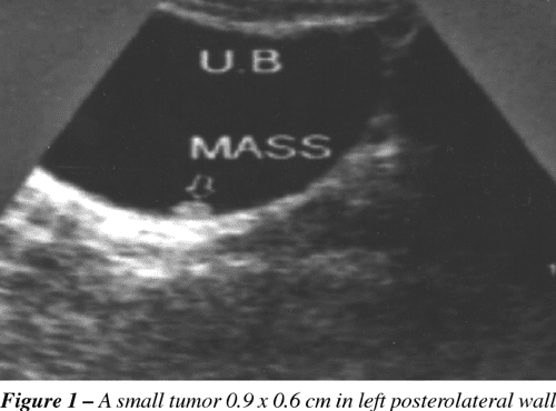 Figure 1 From Role Of Intravenous Urography And Transabdominal 
