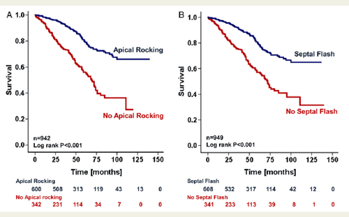 Figure 1 from Relationship of visually assessed apical rocking and ...