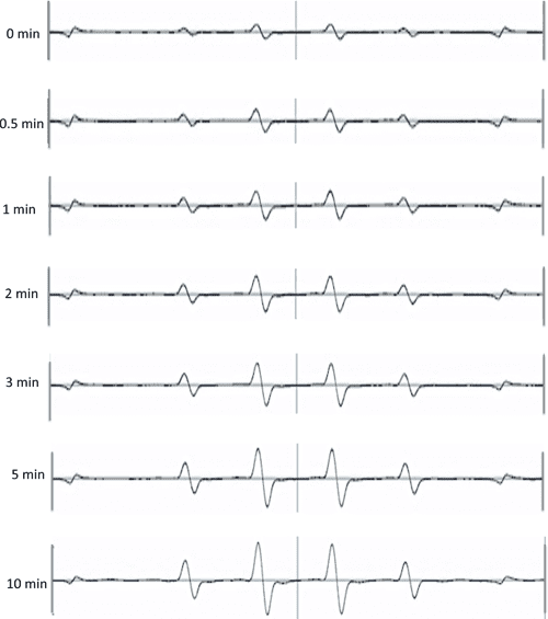 Effects of Hydrogen Peroxide Concentration and Activation Time on
