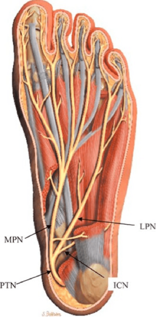 NEUROPATIA DE BAXTER Hallazgos en RM y consideraciones etiológicas