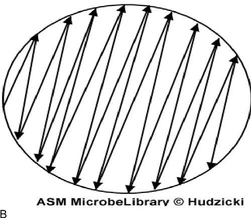 Figure 2 From Kirby Bauer Disk Diffusion Susceptibility Test Protocol Figure 2 From Kirby Bauer Disk Diffusion Susceptibility Test Protocol