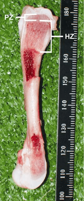Figure 1 from Comparative pathomorphological study of rickets types in ...